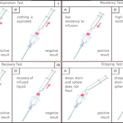 veress needle positioning diagram